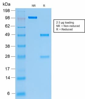 KRT19 / CK19 / Cytokeratin 19 Antibody - SDS-PAGE Analysis of Purified Cytokeratin 19 Recombinant Mouse Monoclonal Antibody (rKRT19/799). Confirmation of Purity and Integrity of the Antibody.