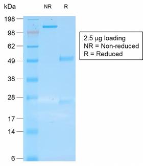 KRT19 / CK19 / Cytokeratin 19 Antibody - SDS-PAGE Analysis Purified CK19 Mouse Recombinant Monoclonal Antibody (rKRT19/800). Confirmation of Purity and Integrity of Antibody.