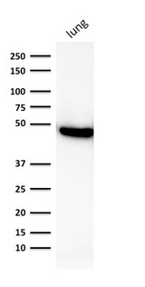 KRT19 / CK19 / Cytokeratin 19 Antibody - Western blot analysis of human lung lysate using CK19 Mouse Recombinant Monoclonal Antibody (rKRT19/800).
