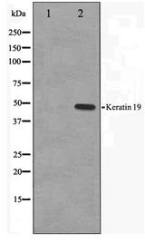 KRT19 / CK19 / Cytokeratin 19 Antibody - Western blot of LOVO cell lysate using Keratin 19 Antibody