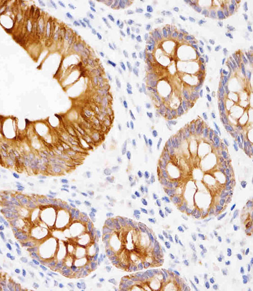 KRT19 / CK19 / Cytokeratin 19 Antibody - Immunohistochemical analysis of KRT19 in Human appendix tissue sections (IHC-P - paraformaldehyde-fixed, paraffin-embedded sections). Tissue was fixed with formaldehyde at room temperature; antigen retrieval was by heat mediation with a EDTA buffer (pH9.0). Samples were incubated with primary antibody (1/200) for 1 hours at room temperature. A undiluted biotinylated CRF Anti-Polyvalent HRP Polymer antibody was used as the secondary antibody.