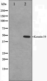 KRT19 / CK19 / Cytokeratin 19 Antibody - Western blot analysis on LOVO cells cell lysates using Keratin 19 antibody. The lane on the left is treated with the antigen-specific peptide.