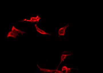 KRT19 / CK19 / Cytokeratin 19 Antibody - Staining LOVO cells by IF/ICC. The samples were fixed with PFA and permeabilized in 0.1% Triton X-100, then blocked in 10% serum for 45 min at 25°C. The primary antibody was diluted at 1:200 and incubated with the sample for 1 hour at 37°C. An Alexa Fluor 594 conjugated goat anti-rabbit IgG (H+L) Ab, diluted at 1/600, was used as the secondary antibody.