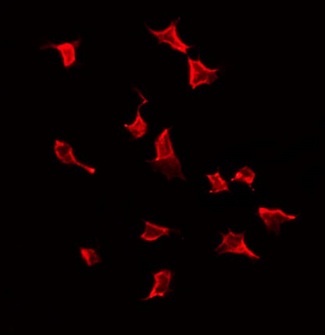 KRT19 / CK19 / Cytokeratin 19 Antibody - Staining LOVO cells by IF/ICC. The samples were fixed with PFA and permeabilized in 0.1% Triton X-100, then blocked in 10% serum for 45 min at 25°C. The primary antibody was diluted at 1:200 and incubated with the sample for 1 hour at 37°C. An Alexa Fluor 594 conjugated goat anti-rabbit IgG (H+L) Ab, diluted at 1/600, was used as the secondary antibody.