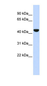 KRT19 / CK19 / Cytokeratin 19 Antibody - KRT19 / Cytokeratin 19 antibody Western blot of Fetal Lung lysate. This image was taken for the unconjugated form of this product. Other forms have not been tested.