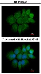 KRT2 / CK2 / Cytokeratin 2 Antibody - Immunofluorescence of paraformaldehyde-fixed A431 using Cytokeratin 2 antibody at 1:200 dilution.