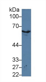 KRT2 / CK2 / Cytokeratin 2 Antibody - Western Blot; Sample: Mouse Skin lysate; Primary Ab: 3µg/ml Rabbit Anti-Mouse KRT2 Antibody Second Ab: 0.2µg/mL HRP-Linked Caprine Anti-Rabbit IgG Polyclonal Antibody