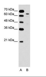 KRT2 / CK2 / Cytokeratin 2 Antibody - A: Marker, B: Jurkat Cell Lysate.  This image was taken for the unconjugated form of this product. Other forms have not been tested.