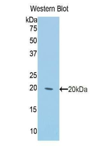 KRT2 / CK2 / Cytokeratin 2 Antibody - Western blot of recombinant KRT2 / CK2 / Cytokeratin 2.  This image was taken for the unconjugated form of this product. Other forms have not been tested.