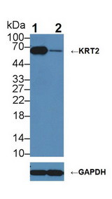 KRT2 / CK2 / Cytokeratin 2 Antibody - Knockout Varification: Lane 1: Wild-type A431 cell lysate; Lane 2: KRT2 knockout A431 cell lysate; Predicted MW: 69kDa Observed MW: 69kDa Primary Ab: 1µg/ml Rabbit Anti-Rat KRT2 Antibody Second Ab: 0.2µg/mL HRP-Linked Caprine Anti-Rabbit IgG Polyclonal Antibody