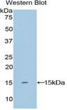 KRT2 / CK2 / Cytokeratin 2 Antibody - Western blot of recombinant KRT2 / CK2 / Cytokeratin 2.  This image was taken for the unconjugated form of this product. Other forms have not been tested.