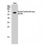 KRT2 / CK2 / Cytokeratin 2 Antibody - Western blot of Acetyl-Cytokeratin-pan (K194) antibody
