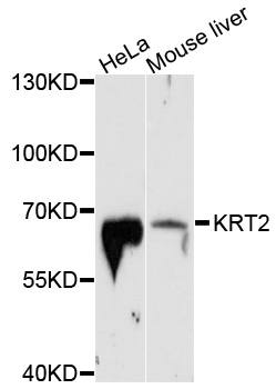 KRT2 / CK2 / Cytokeratin 2 Antibody - Western blot analysis of extracts of various cell lines, using KRT2 antibody at 1:1000 dilution. The secondary antibody used was an HRP Goat Anti-Rabbit IgG (H+L) at 1:10000 dilution. Lysates were loaded 25ug per lane and 3% nonfat dry milk in TBST was used for blocking. An ECL Kit was used for detection and the exposure time was 90s.