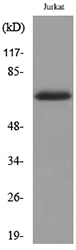 KRT2 / CK2 / Cytokeratin 2 Antibody - Western blot analysis of lysate from Jurkat cells, using Keratin-pan Antibody.