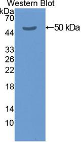 KRT20 / CK20 / Cytokeratin 20 Antibody