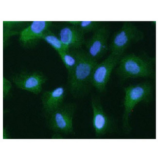 KRT20 / CK20 / Cytokeratin 20 Antibody - ICC/IF analysis of KRT20 in A549 cells, stained with DAPI (Blue) for nucleus staining and monoclonal anti-human KRT20 antibody (1:200) with goat anti-mouse IgG-Alexa fluor 488 conjugate (Green).