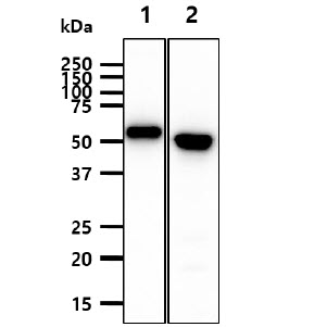 KRT20 / CK20 / Cytokeratin 20 Antibody - The Recombinant Human KRT20 (25ng) and Cell lysates of HeLa, A431(40ug) were resolved by SDS-PAGE, transferred to PVDF membrane and probed with anti-human KRT20 antibody (1:3000). Proteins were visualized using a goat anti-mouse secondary antibody conjugated to HRP and an ECL detection system. Lane 1.: Recombinant Human KRT20 Lane 2.: HeLa cell lysate Lane 3.: A431 cell lysate