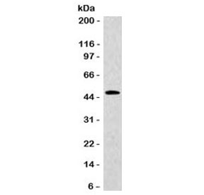 KRT20 / CK20 / Cytokeratin 20 Antibody - Western blot testing of human HT29 cell lysate with KRT20 antibody (clone CTKN20-1). Predicted molecular weight ~46 kDa.
