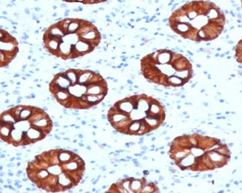 KRT20 / CK20 / Cytokeratin 20 Antibody - IHC testing of human colon with KRT20 antibody (clone CTKN20-1). Required HIER: boil tissue sections in 10mM citrate buffer, pH 6, for 10-20 min followed by cooling at RT for 20 min.