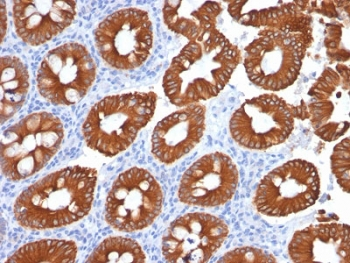 KRT20 / CK20 / Cytokeratin 20 Antibody - IHC testing of human colon with Cytokeratin 20 antibody (clone KRT20/1991). Required HIER: boil tissue sections in 10mM citrate buffer, pH 6, for 10-20 min followed by cooling at RT for 20 min.