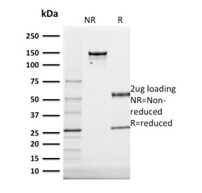 KRT20 / CK20 / Cytokeratin 20 Antibody - SDS-PAGE analysis of purified, BSA-free Cytokeratin 20 antibody (clone KRT20/1991) as confirmation of integrity and purity.