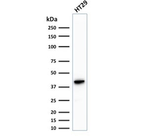 KRT20 / CK20 / Cytokeratin 20 Antibody - Western blot testing of human HT29 cell lysate with CK20 antibody (clone KRT20/1993). Predicted molecular weight ~46 kDa.