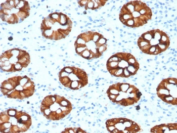 KRT20 / CK20 / Cytokeratin 20 Antibody - IHC testing of human colon with CK20 antibody (clone KRT20/1993). Required HIER: boil tissue sections in 10mM citrate buffer, pH 6, for 10-20 min followed by cooling at RT for 20 min.