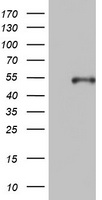 KRT20 / CK20 / Cytokeratin 20 Antibody - HEK293T cells were transfected with the pCMV6-ENTRY control (Left lane) or pCMV6-ENTRY KRT20 (Right lane) cDNA for 48 hrs and lysed. Equivalent amounts of cell lysates (5 ug per lane) were separated by SDS-PAGE and immunoblotted with anti-KRT20.