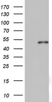 KRT20 / CK20 / Cytokeratin 20 Antibody - HEK293T cells were transfected with the pCMV6-ENTRY control (Left lane) or pCMV6-ENTRY KRT20 (Right lane) cDNA for 48 hrs and lysed. Equivalent amounts of cell lysates (5 ug per lane) were separated by SDS-PAGE and immunoblotted with anti-KRT20.