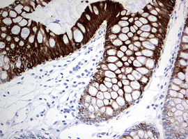 KRT20 / CK20 / Cytokeratin 20 Antibody - IHC of paraffin-embedded Human colon tissue using anti-KRT20 mouse monoclonal antibody. (Heat-induced epitope retrieval by 10mM citric buffer, pH6.0, 120°C for 3min).