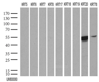 KRT20 / CK20 / Cytokeratin 20 Antibody - HEK293T were transfected with 55 different plasmids of with CK cDNA. (1, 2, 4, 5, 6a, 6b, 6c, 7, 8, 9, 12, 13, 14, 15, 16, 17, 18 v1, 18 v2, 19, 20, 24, 25, 26, 27, 28, 31, 32, 33a, 33b, 34, 35, 36, 37, 38, 39, 40, 71, 72 v1, 72 v3, 73, 74, 75, 76, 77, 78, 79, 80 v1, 80 v2, 81, 82, 83, 84, 85, 86 and 222) for 48 hrs and lysed. Cell lysates. (5 ug per lane) were separated by SDS-PAGE and blotted with KRT19 ab. KRT12, 19, 25, 26, 27, 28 and 39 were positive, while all others were negative. (1:2000).
