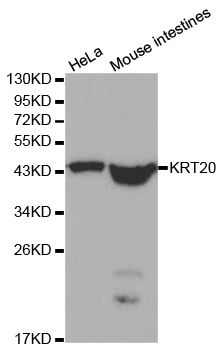 KRT20 / CK20 / Cytokeratin 20 Antibody - Western blot analysis of extracts of various cell lines, using KRT20 antibody at 1:1000 dilution. The secondary antibody used was an HRP Goat Anti-Rabbit IgG (H+L) at 1:10000 dilution. Lysates were loaded 25ug per lane and 3% nonfat dry milk in TBST was used for blocking.