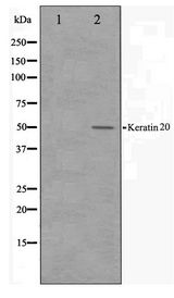 KRT20 / CK20 / Cytokeratin 20 Antibody - Western blot of HeLa cell lysate using Keratin 20 Antibody