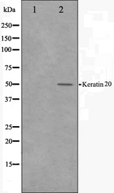 KRT20 / CK20 / Cytokeratin 20 Antibody - Western blot analysis on HeLa cell lysates using Keratin 20 antibody. The lane on the left is treated with the antigen-specific peptide.