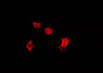 KRT20 / CK20 / Cytokeratin 20 Antibody - Staining HeLa cells by IF/ICC. The samples were fixed with PFA and permeabilized in 0.1% Triton X-100, then blocked in 10% serum for 45 min at 25°C. The primary antibody was diluted at 1:200 and incubated with the sample for 1 hour at 37°C. An Alexa Fluor 594 conjugated goat anti-rabbit IgG (H+L) Ab, diluted at 1/600, was used as the secondary antibody.