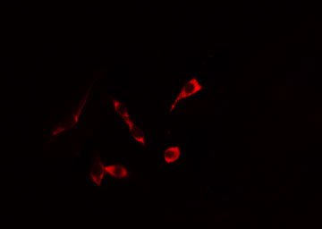KRT20 / CK20 / Cytokeratin 20 Antibody - Staining HeLa cells by IF/ICC. The samples were fixed with PFA and permeabilized in 0.1% Triton X-100, then blocked in 10% serum for 45 min at 25°C. The primary antibody was diluted at 1:200 and incubated with the sample for 1 hour at 37°C. An Alexa Fluor 594 conjugated goat anti-rabbit IgG (H+L) antibody, diluted at 1/600, was used as secondary antibody.