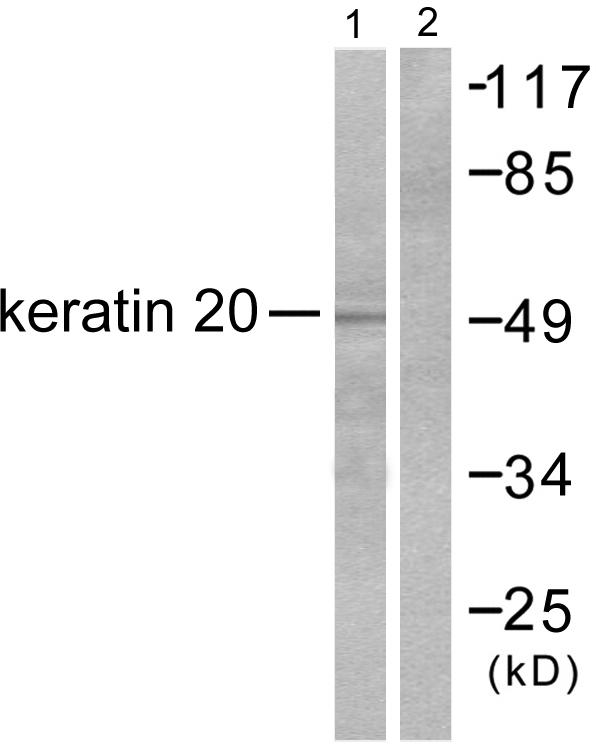 KRT20 / CK20 / Cytokeratin 20 Antibody - Western blot analysis of extracts from HeLa cells, using Keratin 20 antibody.