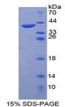 KRT20 / CK20 / Cytokeratin 20 Protein - Recombinant  Keratin 20 By SDS-PAGE