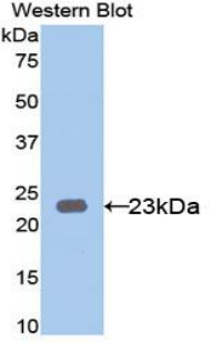 KRT23 / Keratin 23 Antibody - Western blot of recombinant KRT23 / CK3 / Cytokeratin 23.  This image was taken for the unconjugated form of this product. Other forms have not been tested.