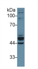 KRT23 / Keratin 23 Antibody - Western Blot; Sample: Human Placenta lysate; Primary Ab: 1µg/ml Rabbit Anti-Human KRT23 Antibody Second Ab: 0.2µg/mL HRP-Linked Caprine Anti-Rabbit IgG Polyclonal Antibody