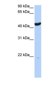 KRT23 / Keratin 23 Antibody - KRT23 / Cytokeratin 23 antibody Western blot of 721_B cell lysate. This image was taken for the unconjugated form of this product. Other forms have not been tested.