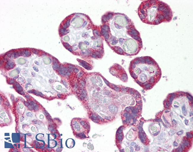 KRT23 / Keratin 23 Antibody - Anti-KRT23 / Cytokeratin 23 antibody IHC of human placenta. Immunohistochemistry of formalin-fixed, paraffin-embedded tissue after heat-induced antigen retrieval. Antibody concentration 5 ug/ml.  This image was taken for the unconjugated form of this product. Other forms have not been tested.