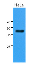 KRT23 / Keratin 23 Antibody - Western Blot: The cell lysates of HeLa (30 ug) were resolved by SDS-PAGE, transferred to PVDF membrane and probed with anti-human KRT23 antibody (1:3000). Proteins were visualized using a goat anti-mouse secondary antibody conjugated to HRP and an ECL detection system.