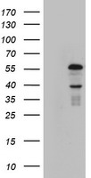 KRT24 / Keratin 24 Antibody - HEK293T cells were transfected with the pCMV6-ENTRY control (Left lane) or pCMV6-ENTRY KRT24 (Right lane) cDNA for 48 hrs and lysed. Equivalent amounts of cell lysates (5 ug per lane) were separated by SDS-PAGE and immunoblotted with anti-KRT24.