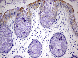 KRT24 / Keratin 24 Antibody - IHC of paraffin-embedded Human colon tissue using anti-KRT24 mouse monoclonal antibody. (Heat-induced epitope retrieval by 10mM citric buffer, pH6.0, 120°C for 3min).