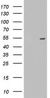 KRT24 / Keratin 24 Antibody - HEK293T cells were transfected with the pCMV6-ENTRY control (Left lane) or pCMV6-ENTRY KRT24 (Right lane) cDNA for 48 hrs and lysed. Equivalent amounts of cell lysates (5 ug per lane) were separated by SDS-PAGE and immunoblotted with anti-KRT24.