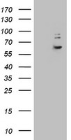 KRT24 / Keratin 24 Antibody - HEK293T cells were transfected with the pCMV6-ENTRY control (Left lane) or pCMV6-ENTRY KRT24 (Right lane) cDNA for 48 hrs and lysed. Equivalent amounts of cell lysates (5 ug per lane) were separated by SDS-PAGE and immunoblotted with anti-KRT24.