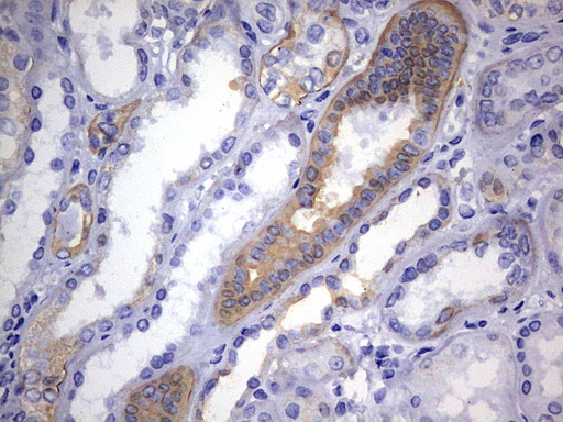 KRT24 / Keratin 24 Antibody - IHC of paraffin-embedded Human Kidney tissue using anti-KRT24 mouse monoclonal antibody. (Heat-induced epitope retrieval by 1 mM EDTA in 10mM Tris, pH9.0, 120°C for 3min).