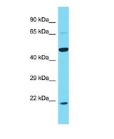 KRT25 / Keratin 25 Antibody - Western blot of KRT25 Antibody - C-terminal region with human PANC1 cells lysate.  This image was taken for the unconjugated form of this product. Other forms have not been tested.