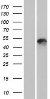 KRT25 / Keratin 25 Protein - Western validation with an anti-DDK antibody * L: Control HEK293 lysate R: Over-expression lysate